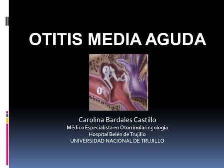 OTITIS MEDIA AGUDA Carolina Bardales Castillo