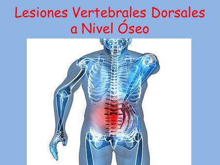 Lesiones Vertebrales Dorsales a Nivel Óseo