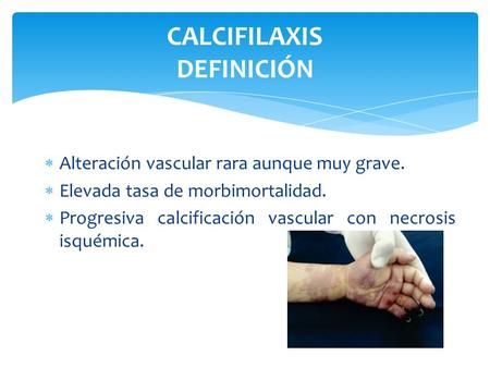 CALCIFILAXIS DEFINICIÓN