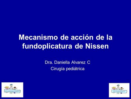Mecanismo de acción de la fundoplicatura de Nissen