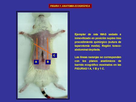 FIGURA 1: ANATOMIA ECOGRÁFICA