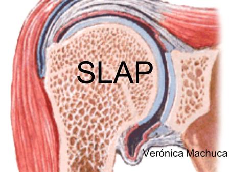 SLAP Verónica Machuca.