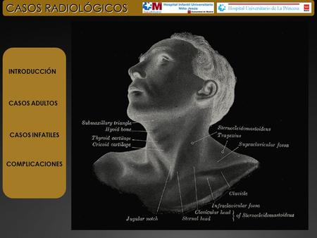 CASOS RADIOLÓGICOS INTRODUCCIÓN CASOS ADULTOS CASOS INFATILES