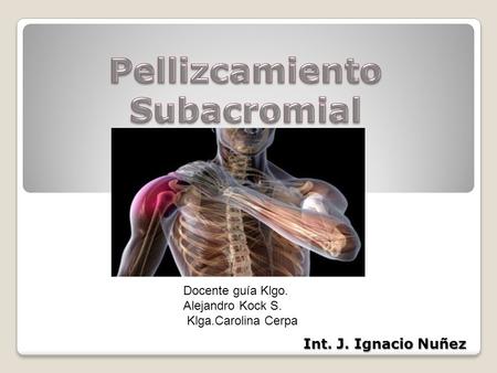 Pellizcamiento Subacromial