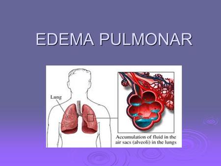 EDEMA PULMONAR.