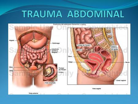TRAUMA ABDOMINAL.