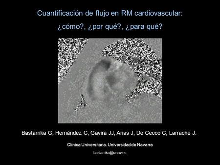 Cuantificación de flujo en RM cardiovascular: