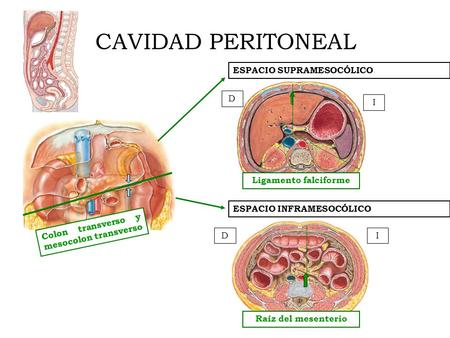 CAVIDAD PERITONEAL ESPACIO SUPRAMESOCÓLICO D I Ligamento falciforme
