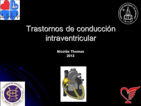 Trastornos de conducción intraventricular
