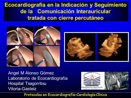 Protocolos en Ecocardiografía-Cardiología Clínica
