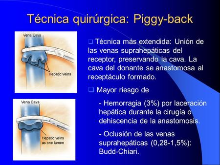 Técnica quirúrgica: Piggy-back
