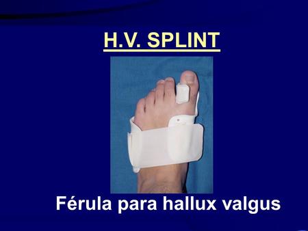 Férula para hallux valgus