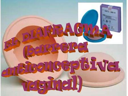 EL DIAFRAGMA (barrera anticonceptiva vaginal).