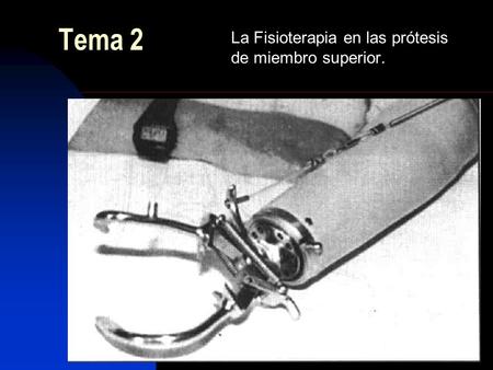 La Fisioterapia en las prótesis de miembro superior.