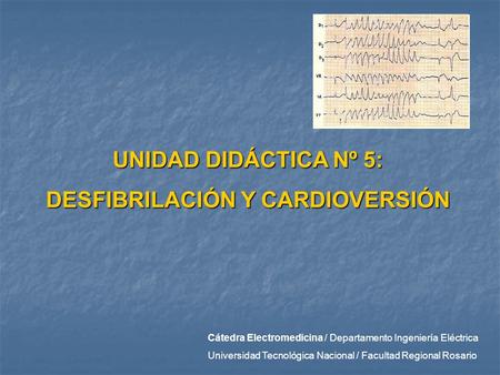 DESFIBRILACIÓN Y CARDIOVERSIÓN