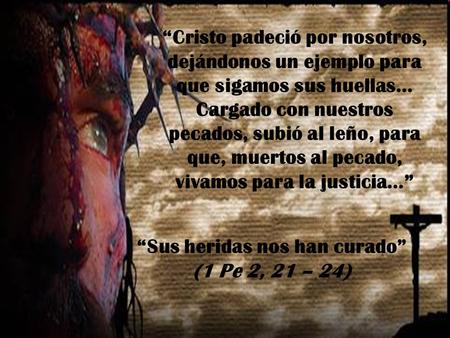 “Cristo padeció por nosotros, dejándonos un ejemplo para que sigamos sus huellas… Cargado con nuestros pecados, subió al leño, para que, muertos al pecado,