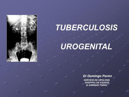 TUBERCULOSIS UROGENITAL