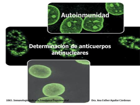 Determinación de anticuerpos antinucleares