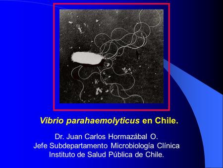 Vibrio parahaemolyticus en Chile.