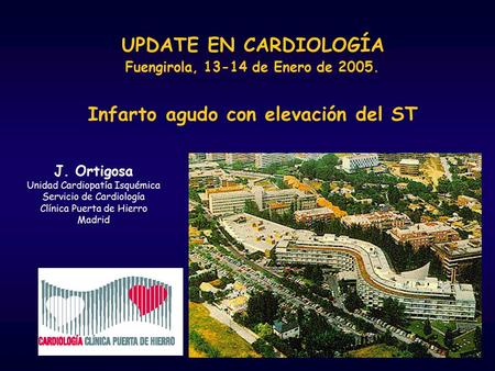 UPDATE EN CARDIOLOGÍA Fuengirola, 13-14 de Enero de 2005. Infarto agudo con elevación del ST J. Ortigosa Unidad Cardiopatía Isquémica Servicio de Cardiología.