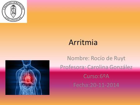 Arritmia Nombre: Rocío de Ruyt Profesora: Carolina González Curso:6ºA Fecha:20-11-2014.