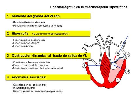 Ecocardiografía en la Miocardiopatía Hipertrófica