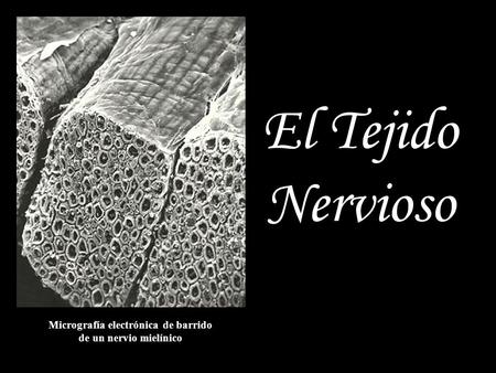 Micrografía electrónica de barrido de un nervio mielínico