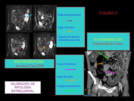 VALORACIÓN DE PATOLOGÍA EXTRALUMINAL
