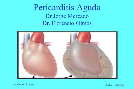 Fundación Reussi AMA - SMIBA Pericarditis Aguda Dr Jorge Mercado Dr. Florencio Olmos.