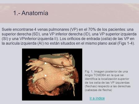 1.- Anatomía Suele encontrarse 4 venas pulmonares (VP) en el 70% de los pacientes: una superior derecha (SD), una VP inferior derecha (ID), una VP superior.