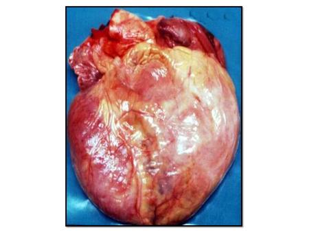 INSUFICIENCIA CARDIACA es un complejo síndrome clínico que resulta de cualquier daño estructural o funcional del llenado ventricular o de la eyección.