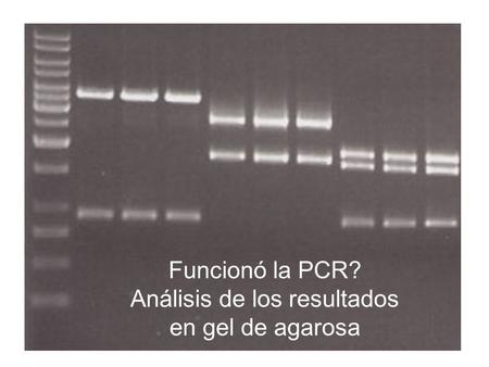 Análisis de los resultados en gel de agarosa