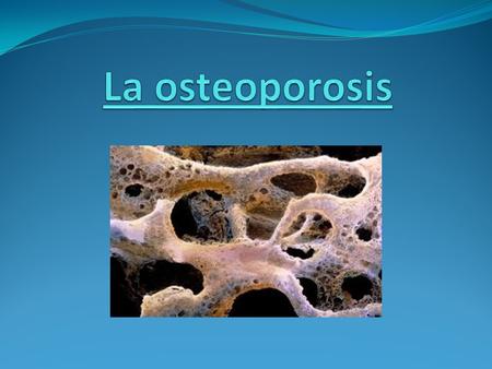 La osteoporosis.