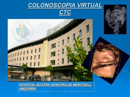 COLONOSCOPIA VIRTUAL CTC