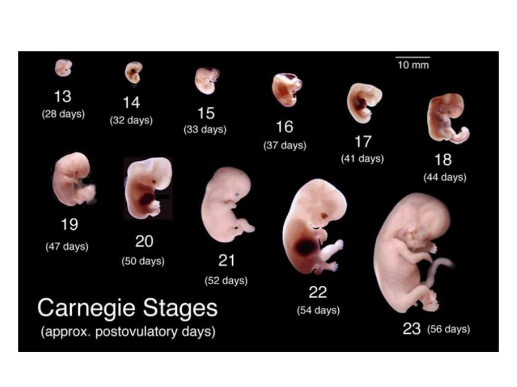 Развитие плода по неделям. Развитие эмбриона по неделям. Этапы развития зародыша человека по неделям. Человеческий эмбрион по неделям. Стадии формирования эмбриона человека по неделям.