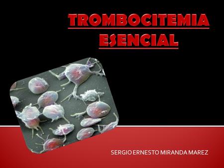 TROMBOCITEMIA ESENCIAL