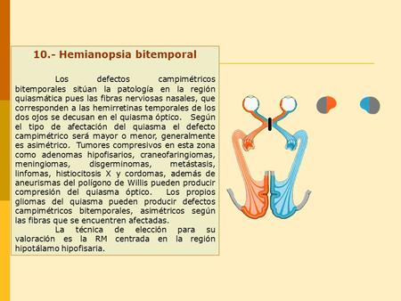 10.- Hemianopsia bitemporal