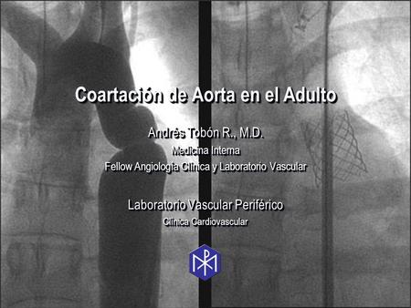 Coartación de Aorta en el Adulto