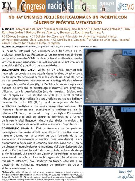 NO HAY ENEMIGO PEQUEÑO: FECALOMA EN UN PACIENTE CON CÁNCER DE PRÓSTATA METASTASICO AUTORES: Mayra Acosta Rozo 1; María Nuria Requeno Jarabo 2; Alberto.