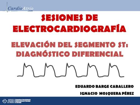 SESIONES DE ELECTROCARDIOGRAFÍA