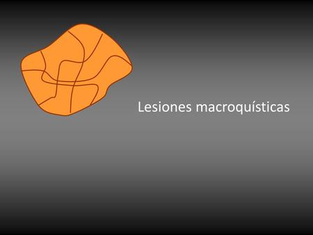 Lesiones macroquísticas