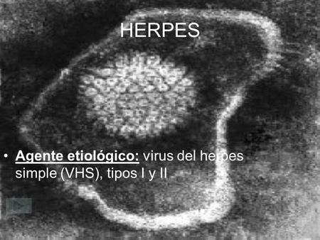 HERPES Agente etiológico: virus del herpes simple (VHS), tipos I y II.