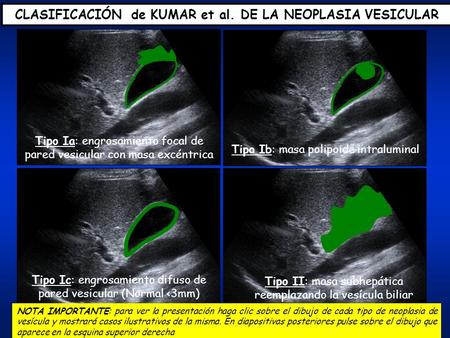 CLASIFICACIÓN de KUMAR et al. DE LA NEOPLASIA VESICULAR