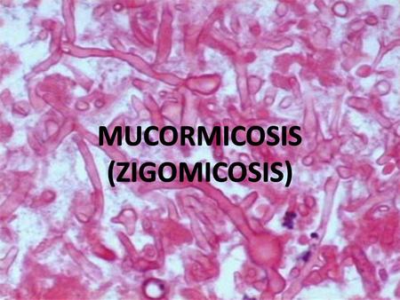 MUCORMICOSIS (ZIGOMICOSIS).