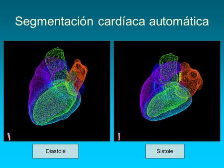 Segmentación cardíaca automática