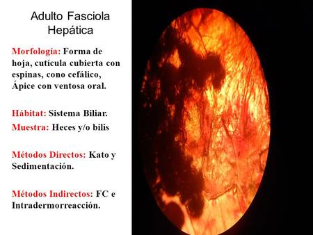 Adulto Fasciola Hepática