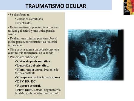 TRAUMATISMO OCULAR Cerrados o contusos. Penetrantes.