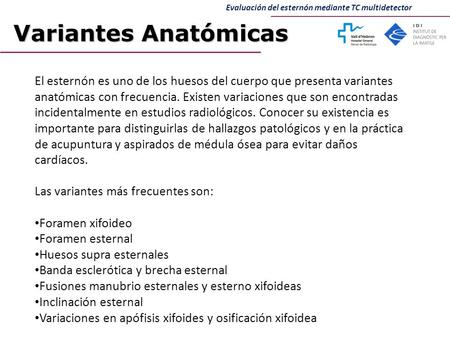 Evaluación del esternón mediante TC multidetector