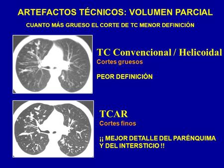 ARTEFACTOS TÉCNICOS: VOLUMEN PARCIAL
