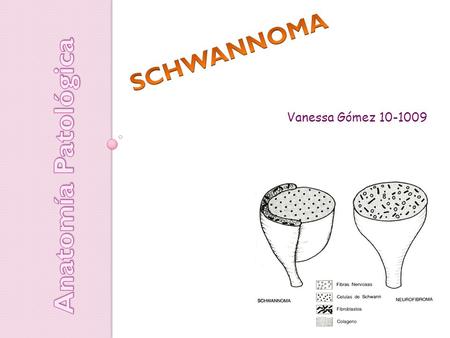 SCHWANNOMA Vanessa Gómez 10-1009 Anatomía Patológica.